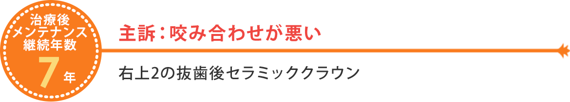 咬みあわせが悪い