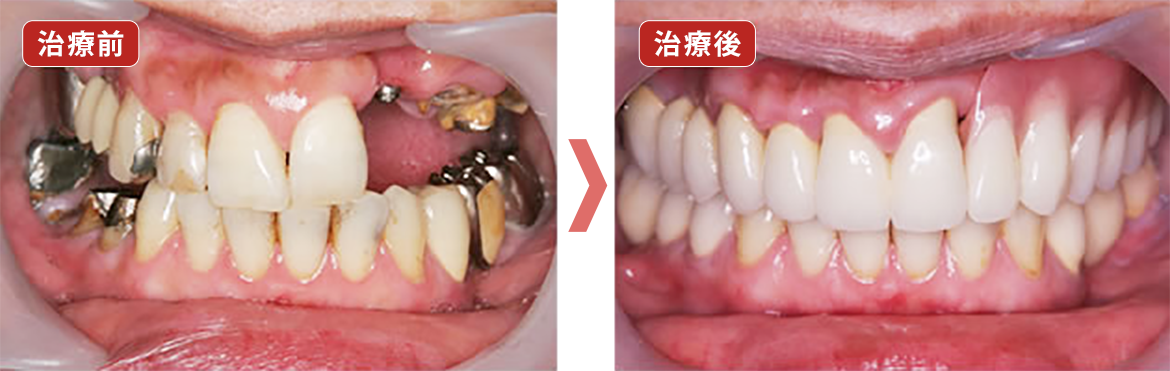 治療前　治療後