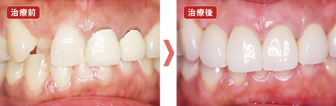 治療前　治療後