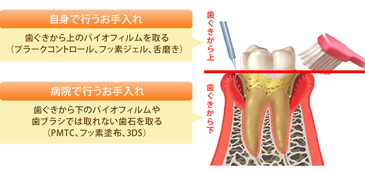 お手入れについて